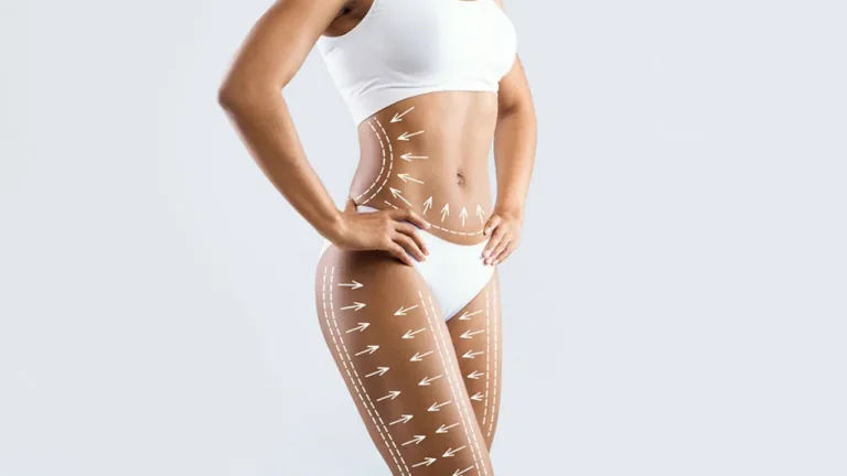 360° Tummy Tuck