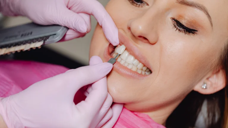 Hollywood Smile: Krok po kroku do idealnego uśmiechu